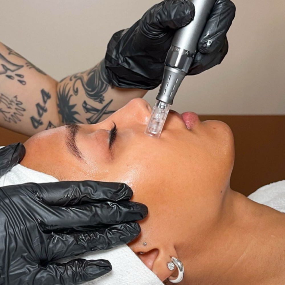 ✨Nano Glow Infusion Facial✨ at Skin Deep Beauty Spa in Sulphur, LA