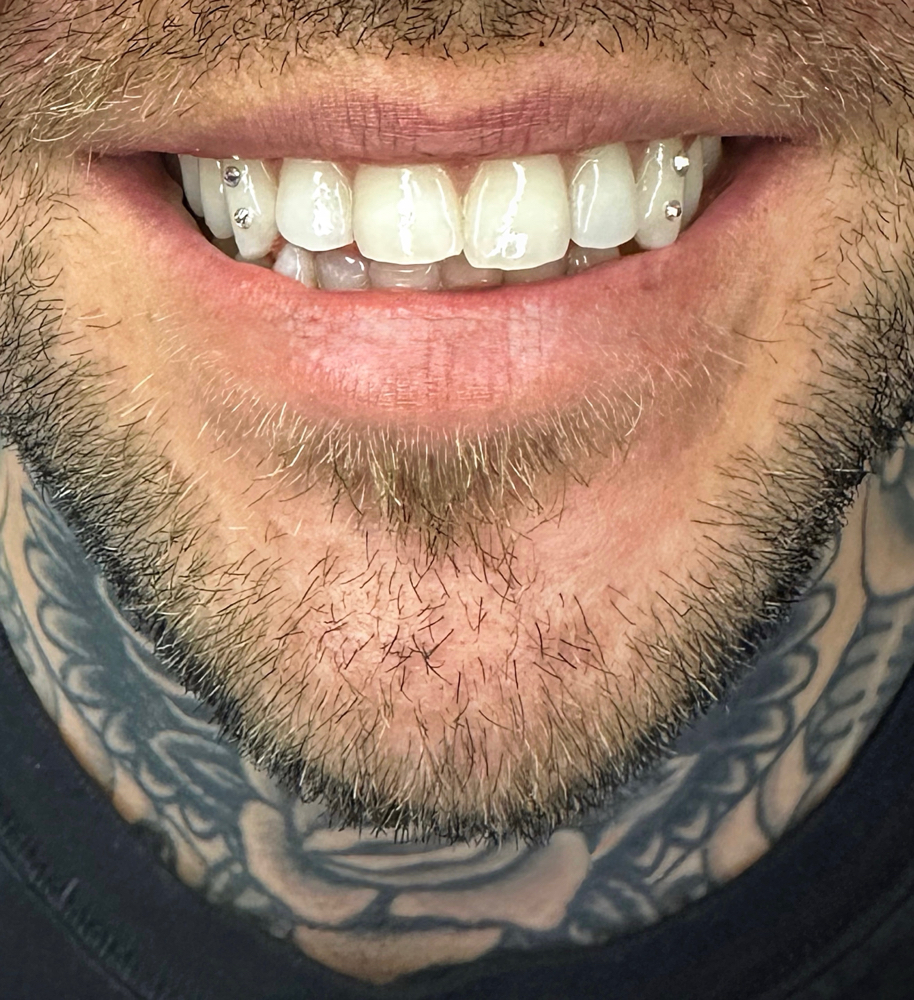 Tooth Gems For 2
