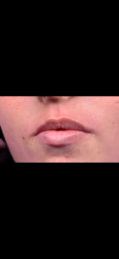 Upper Lip Wax