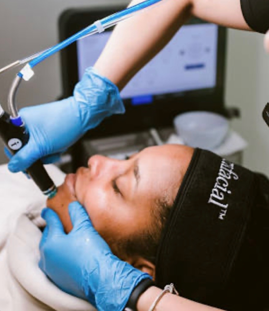 Deluxe Hydrafacial Treatment at Beautyful Aesthetics in Edmond, OK