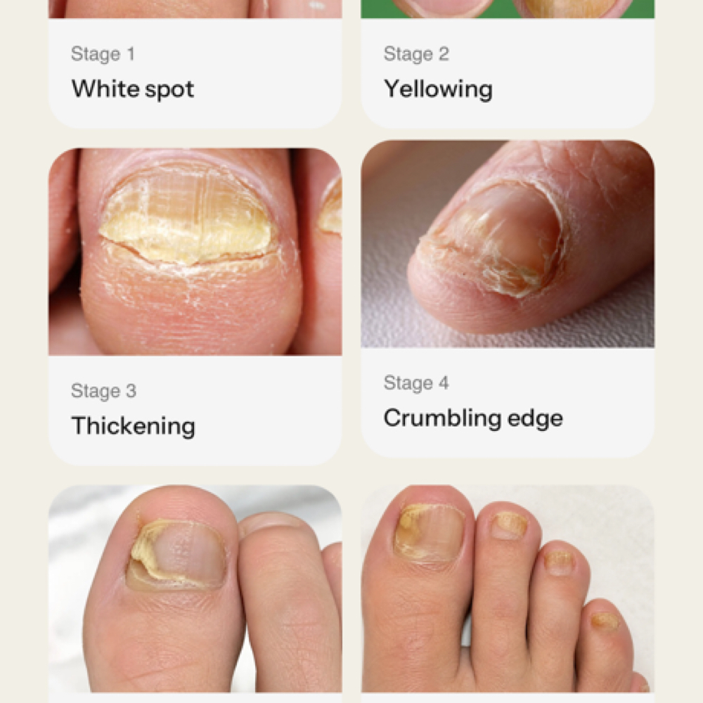 Advanced Medical Grade Foot Care at Southern Sparkle Medical Aesthetics in Swainsboro, GA
