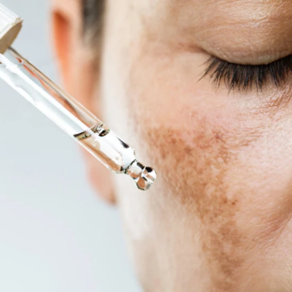 Chemical Peel Spot Treatment at Clair Elizabeth Beauty & Co: Massage, Skin, Beauty in Longmont, CO