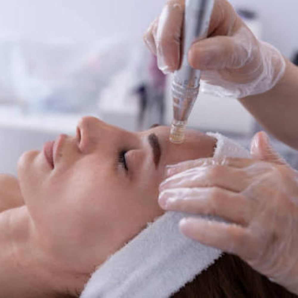 Microneedling Advanced Collagen at Mina’s Lovely Beauty Bar in Commack, NY