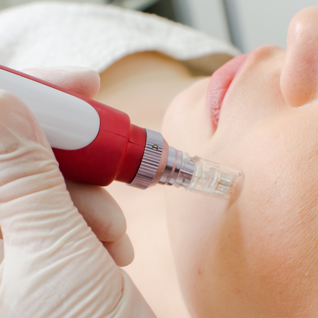 Anti-Aging Microneedling