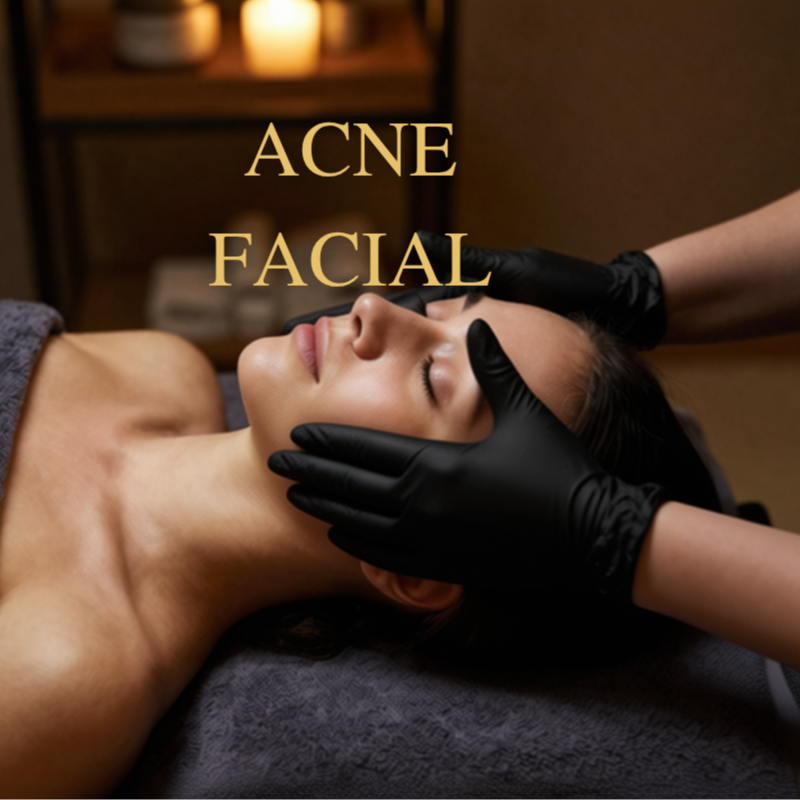 Acne Facial at Sunset Glow Sugar & Skin in San Diego, CA