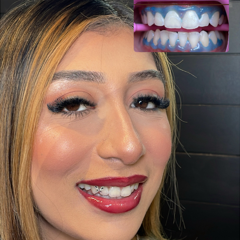 Teeth Whitening + Tooth Gem Trainin at Luxurious Enamel in Phoenix, AZ