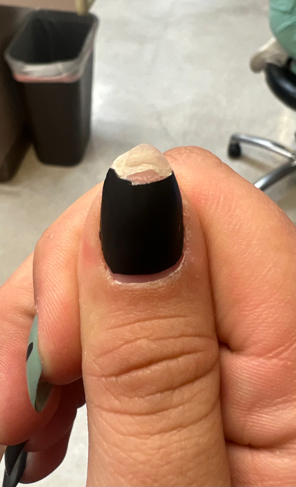 Nail Repair