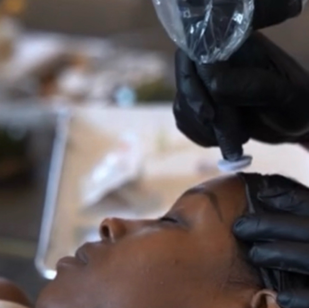 Microchanneling - Hyperpigmentation at BE TRU BEAUTY SPA in Fairfield, CT