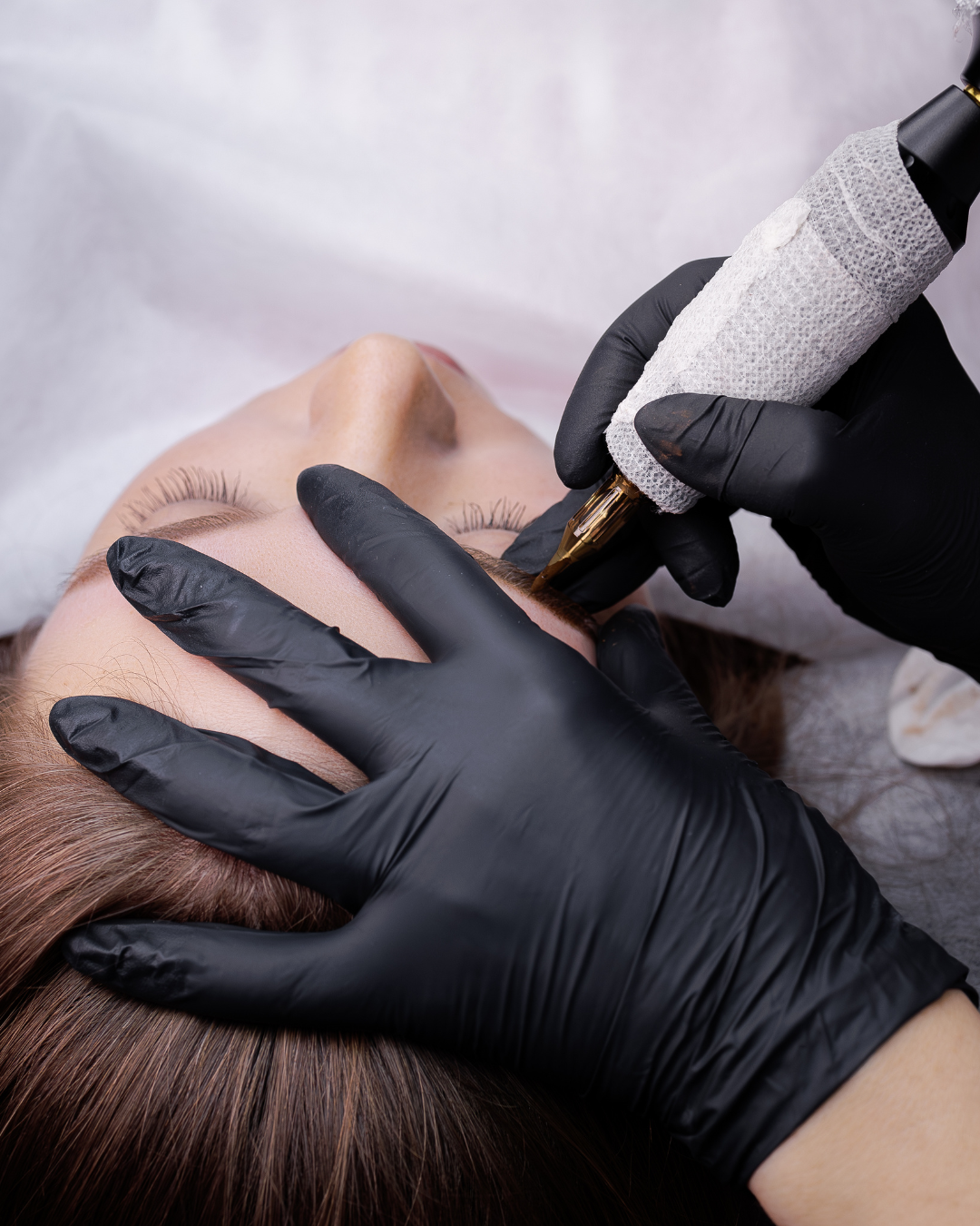 Removal/Pigment Lightening $200