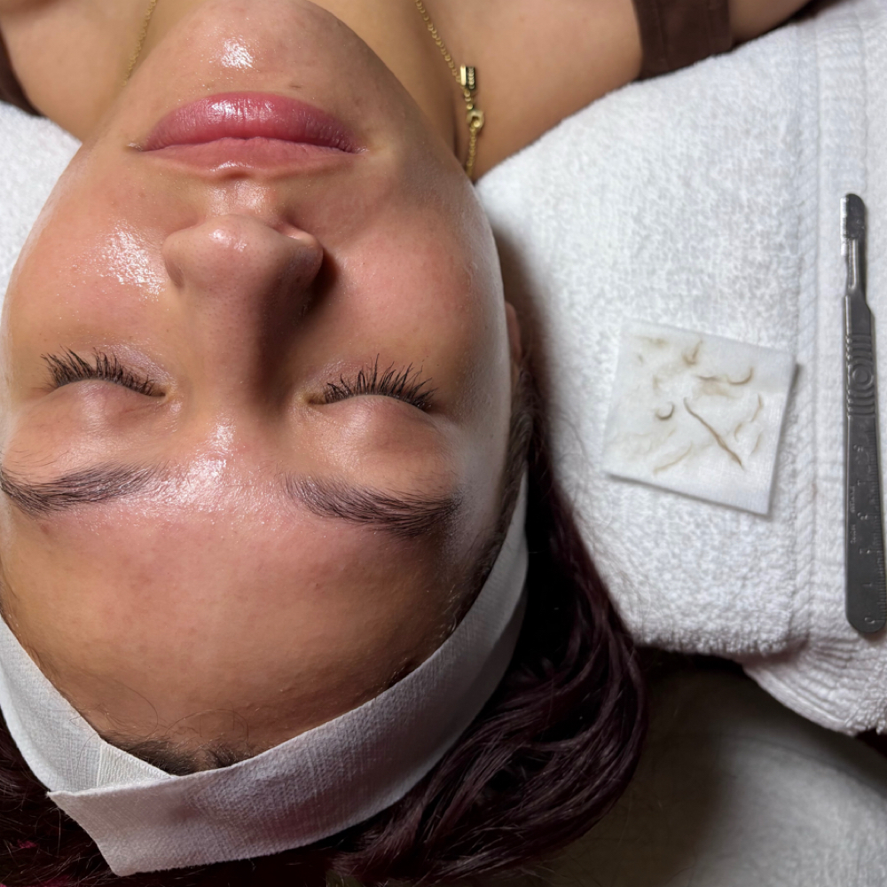 Dermaplane Facial at Livingood Esthetics in Richmond, KY