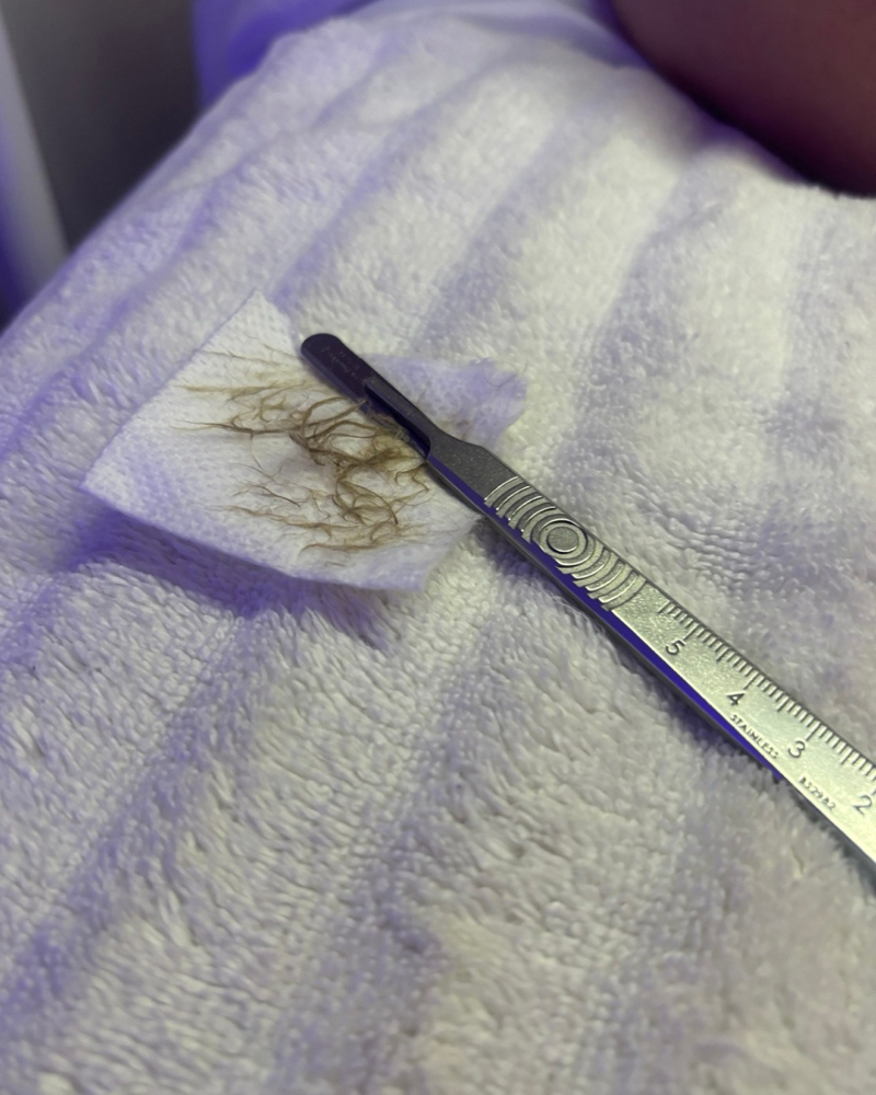 Dermaplane Glow Facial