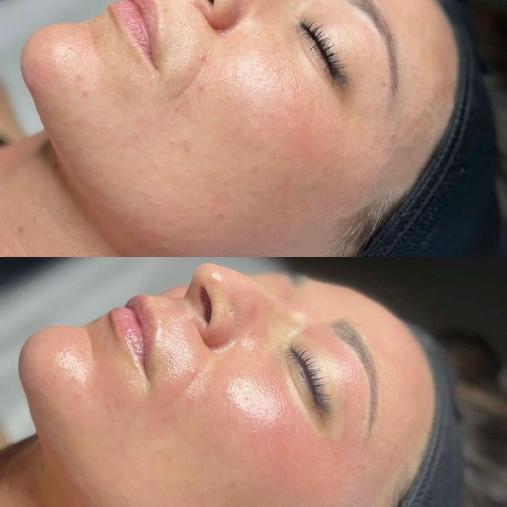 Rejuventating facial 🧖🏾‍♀️ at T’Maria Touches in Lemoore, CA