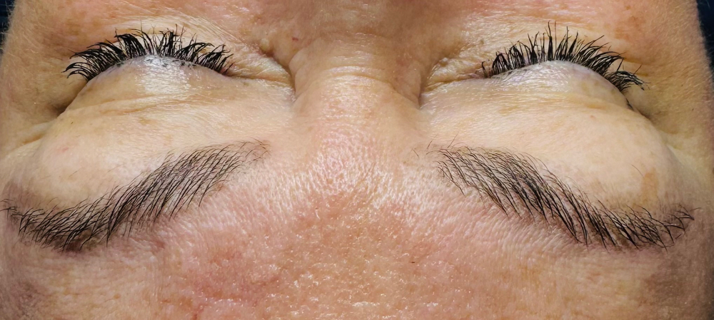 Brow Lamination