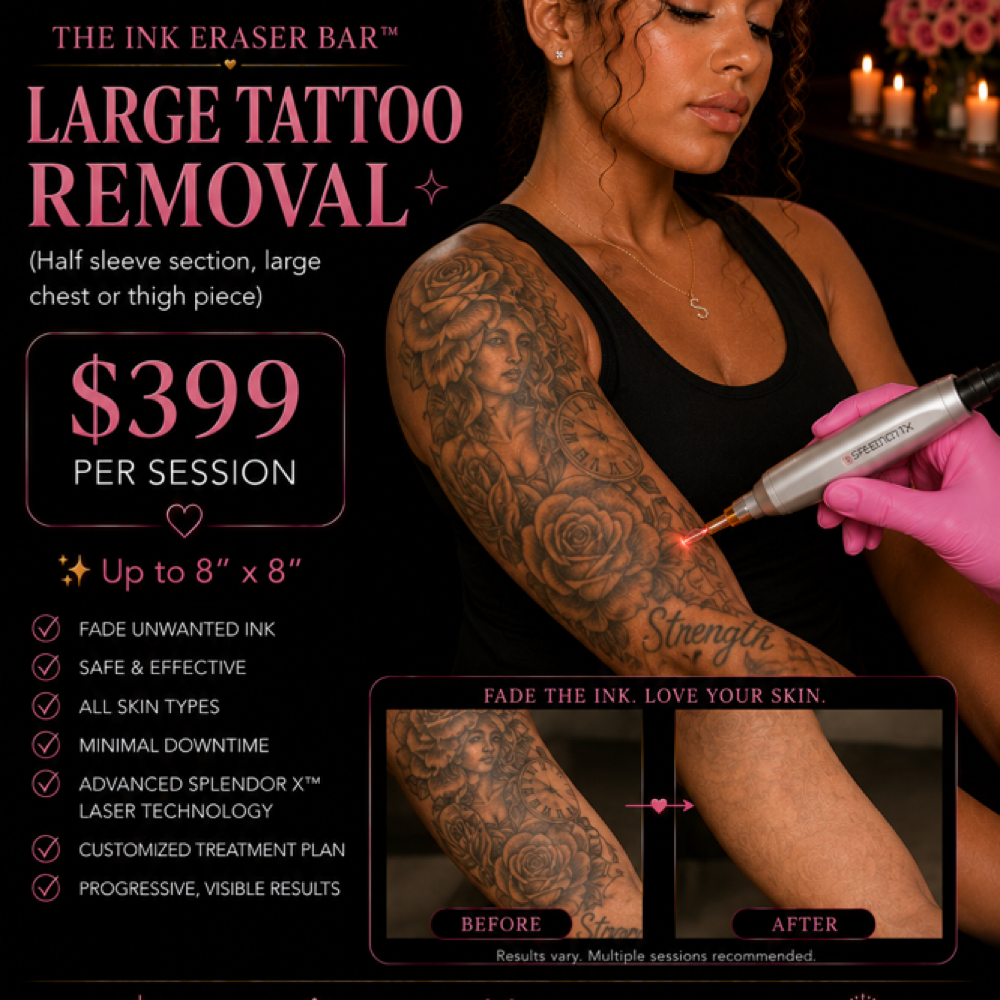Large Tattoo Removal at Silk Society Beauty Bar in Houston, TX