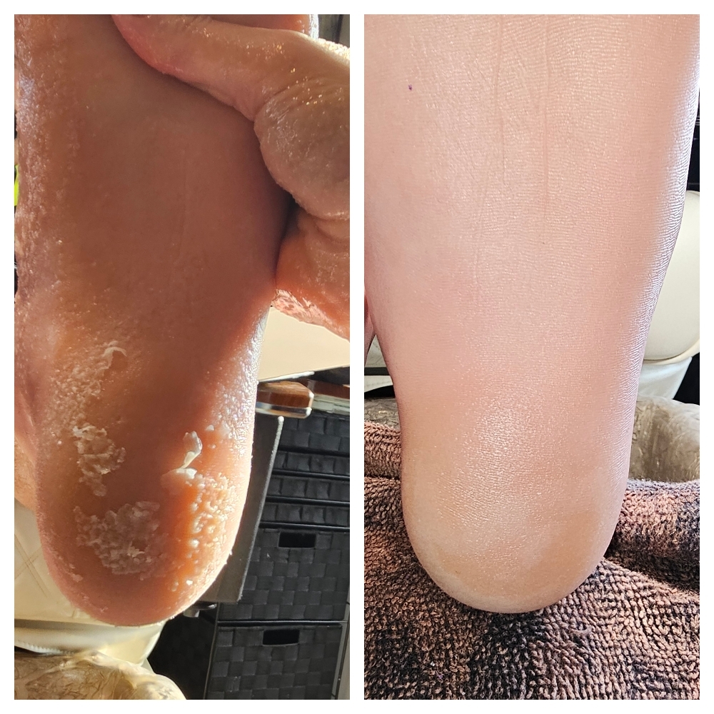 Pedicure Deep Conditioning
