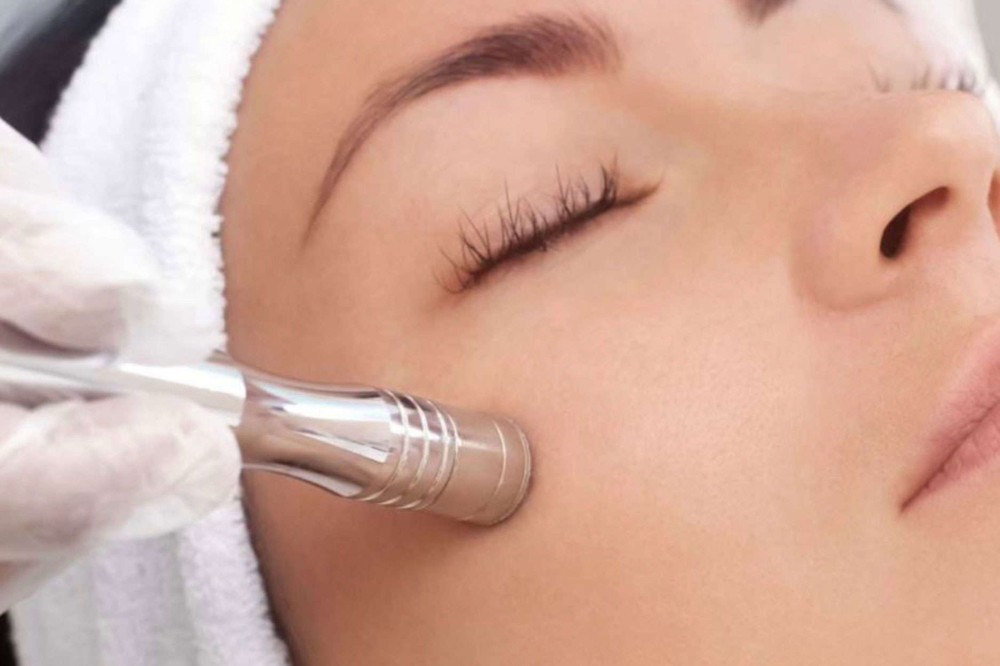 Microdermabrasion