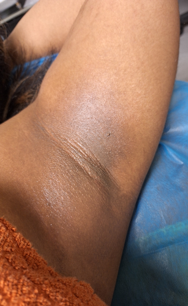 Underarm Wax