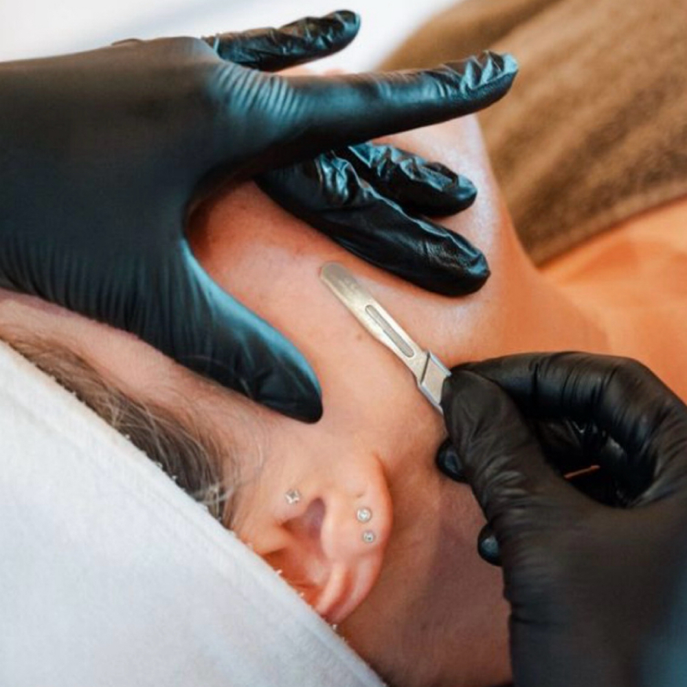 Dermaplane Facial at Retro Esthetics in San Clemente, CA