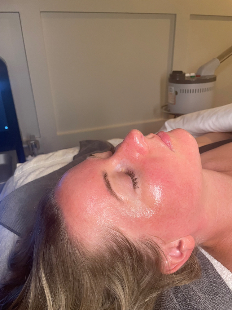 Signature Hydrafacial