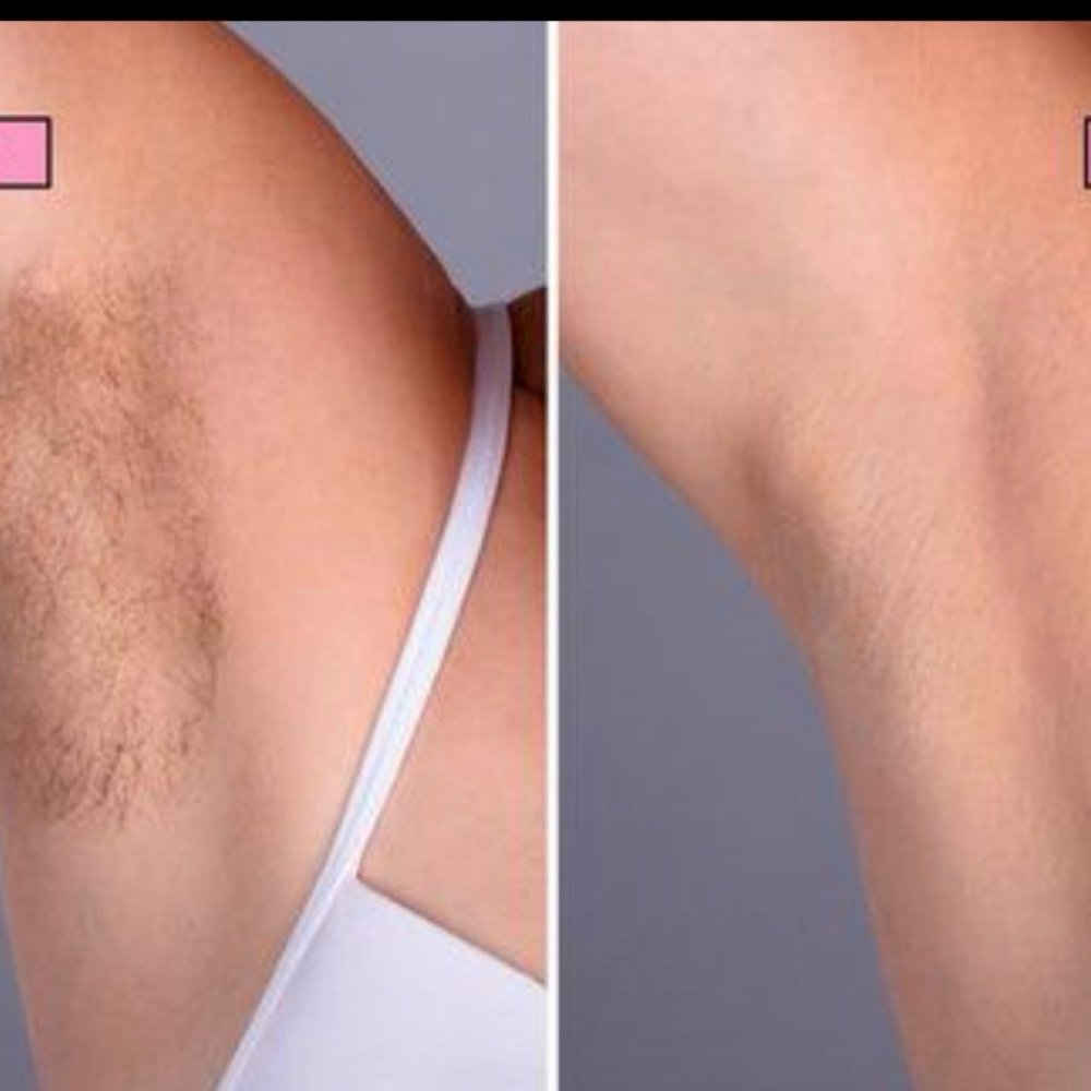 Waxing- Underarms at Beauty Spa 11 in Mission, KS