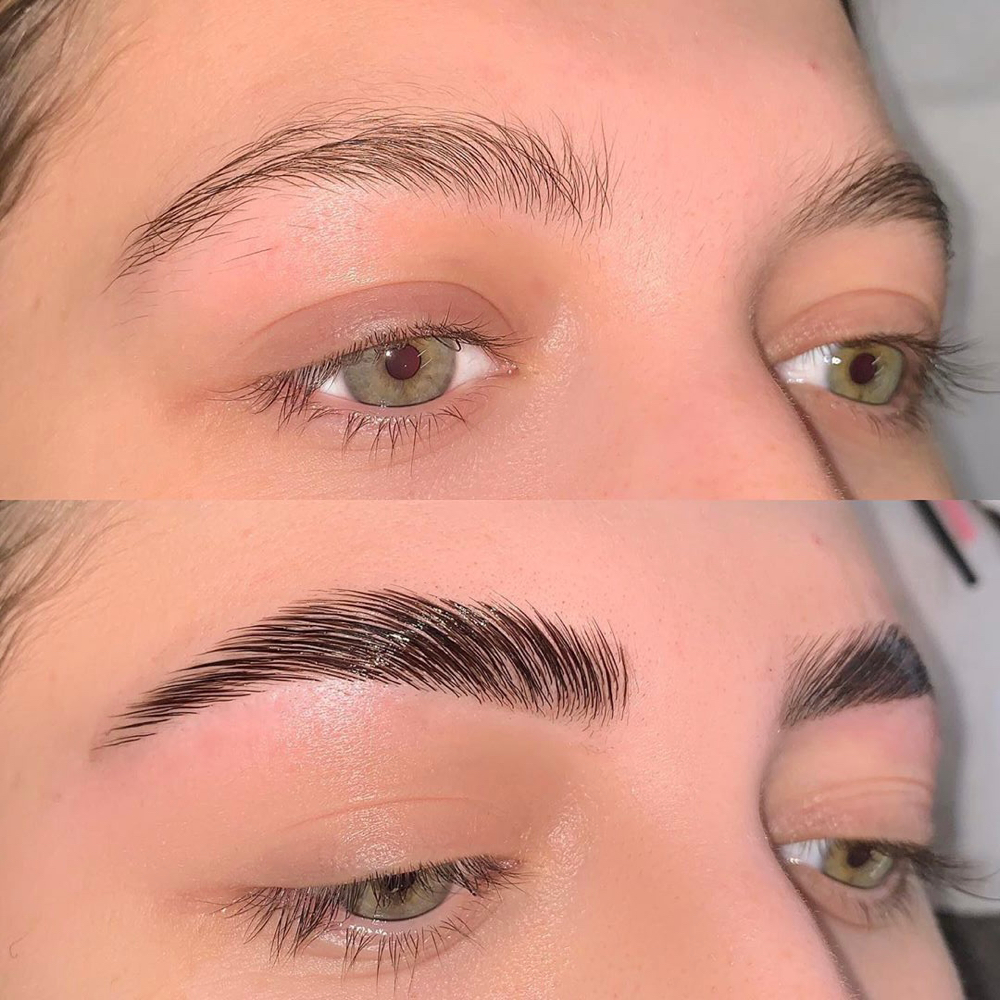 Brow Lamination