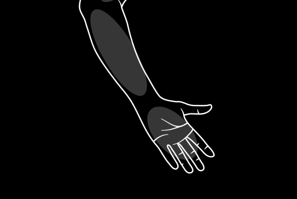 Half Arm (Upper Or Lower)