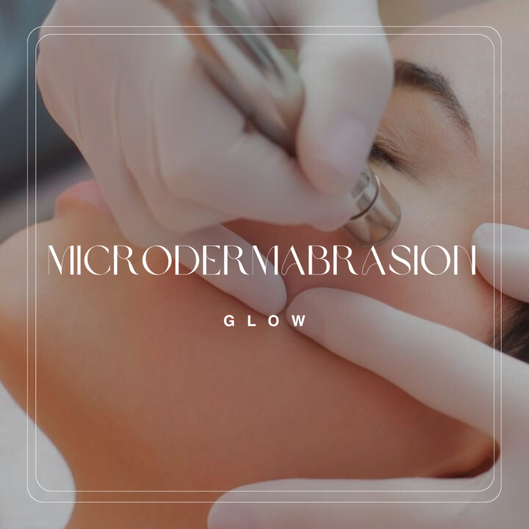 Microdermabrasion Glow 🤍 at A GLOW in Metaire, LA