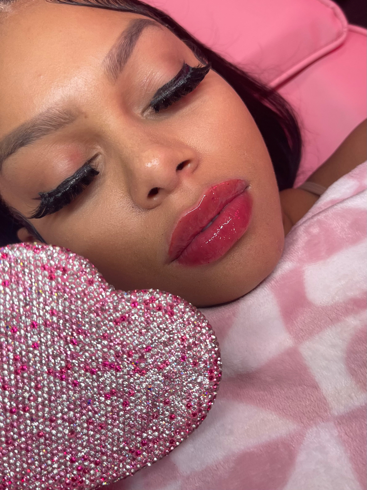 Needle-Free Lip Fillers 0.5-1 ML