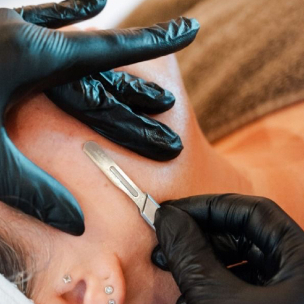 Dermaplane at Nutured Skin LLC in Venice, FL