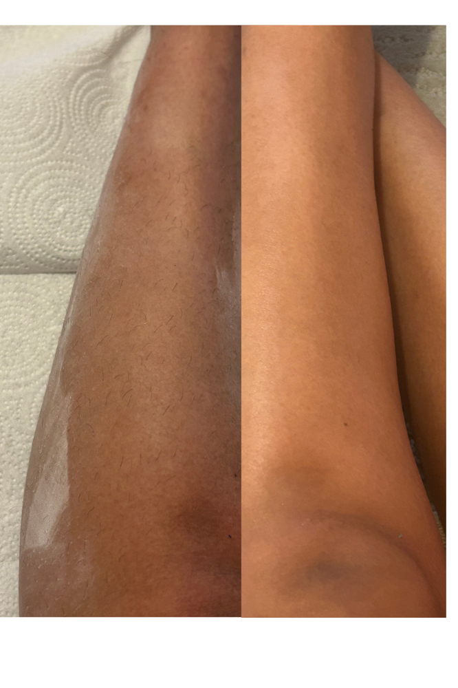 Lower Leg Wax