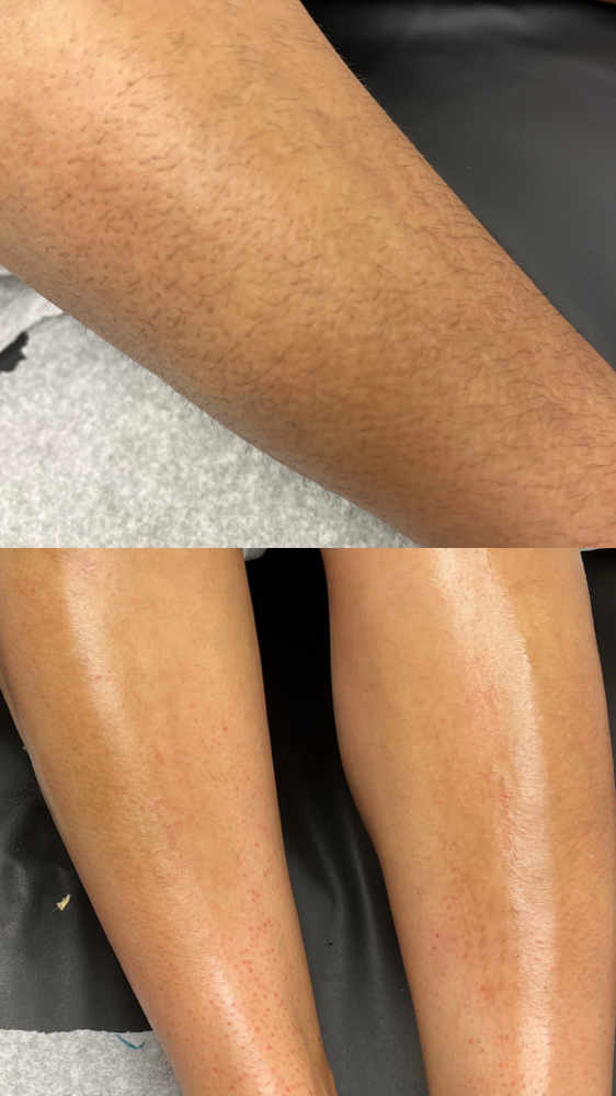 Full Leg Wax