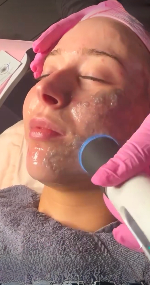 OxyPro Facial