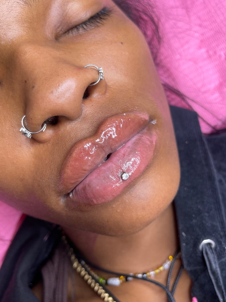 2.5ml Elasty G