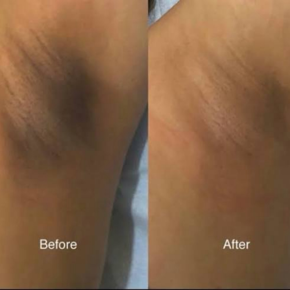 Intimate Brightening Services at Haus of Beauty Studio in Hialeah, FL