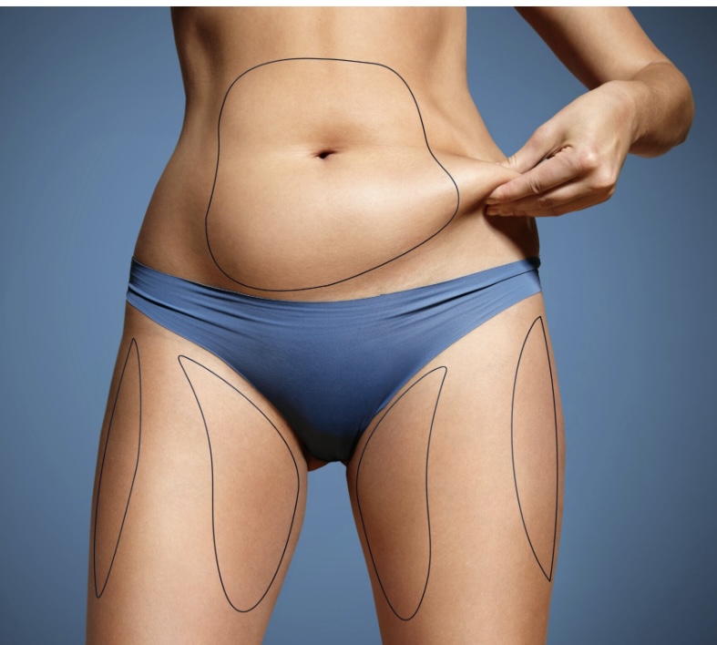 Body Contouring Package