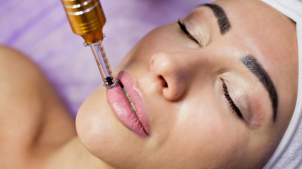 Lip Plumping - Microneedling