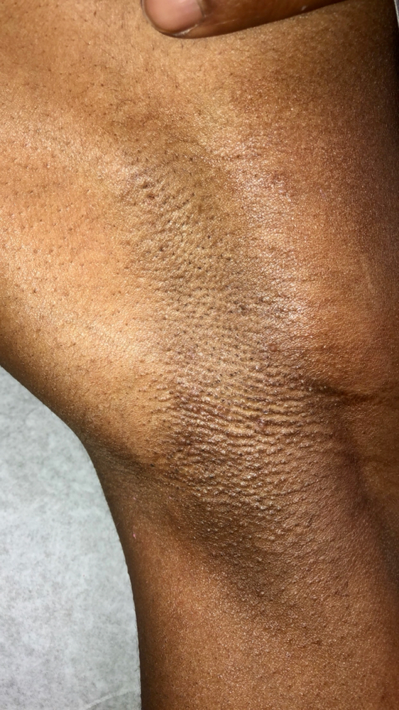 Underarms at The Wax Society in Birmingham, AL