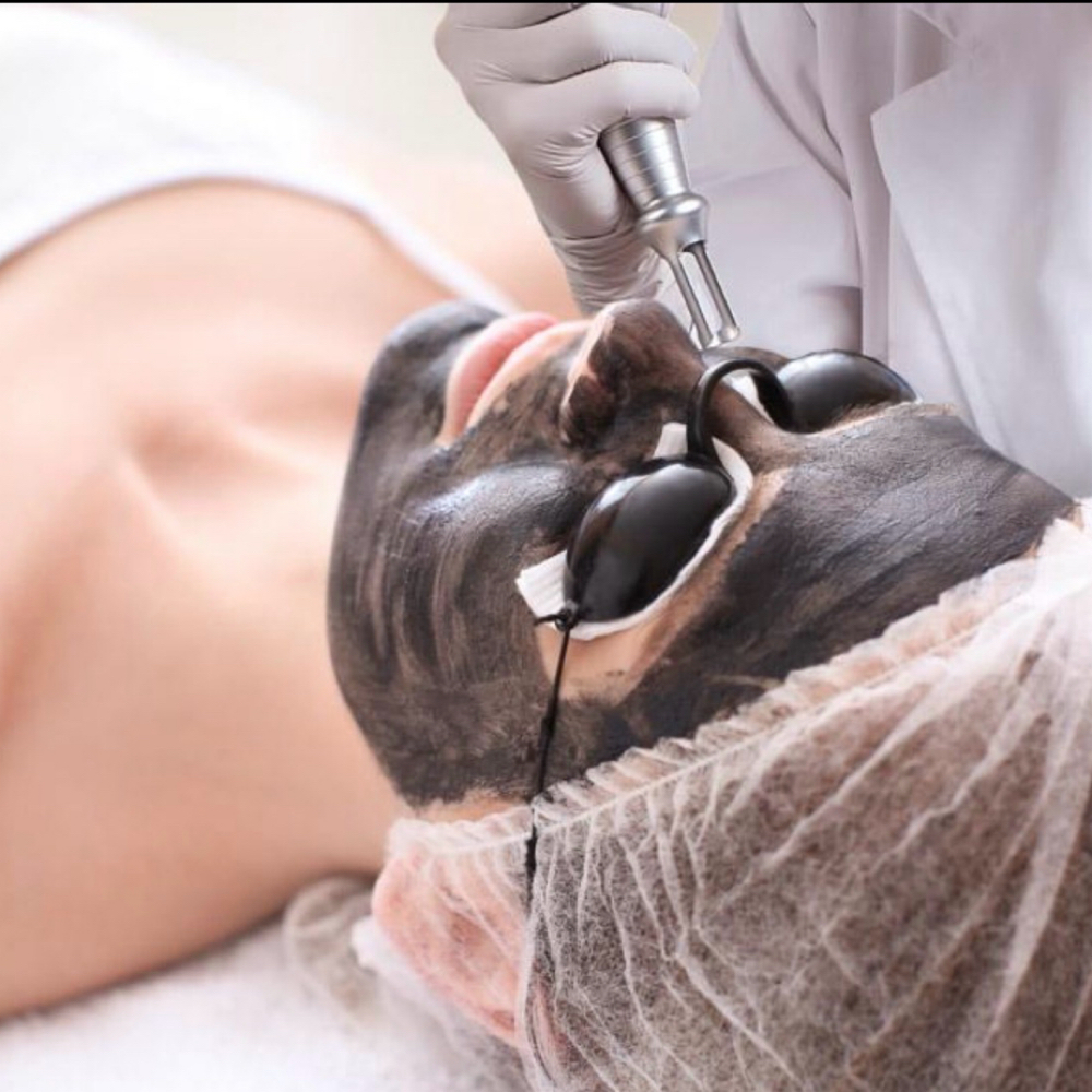 Hollywood Peel (6) at La Belle Studio by Soraya in Woburn, MA