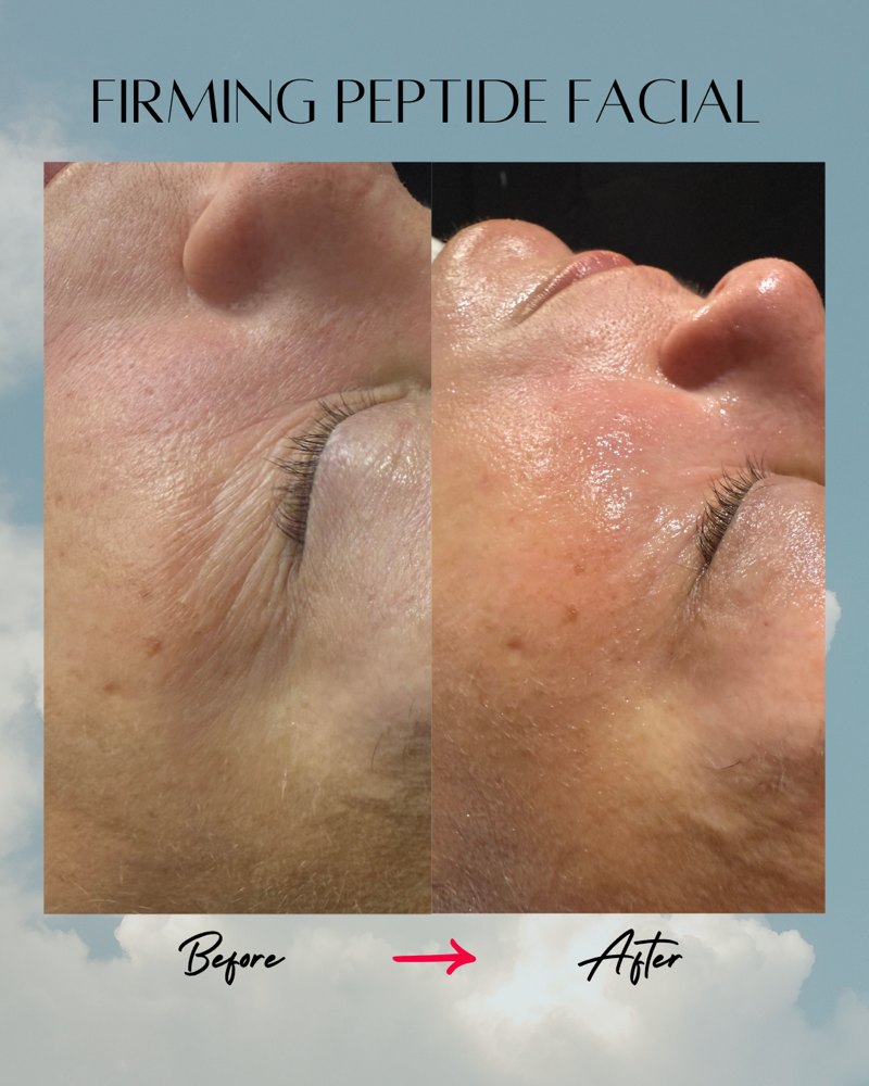 Sanctuary Sculpt Facial at Sam’s Beauty Studio in Rochester Hills, MI