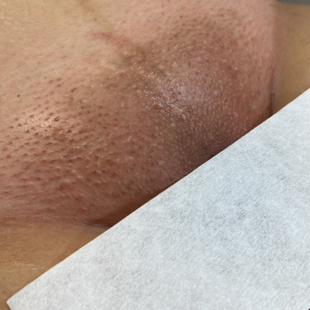 Brazilian at Simply Waxed in Fontana, CA