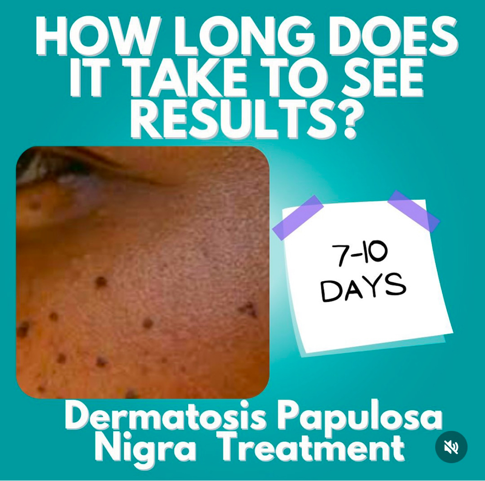 DPN Skin Tag Removal 60&up