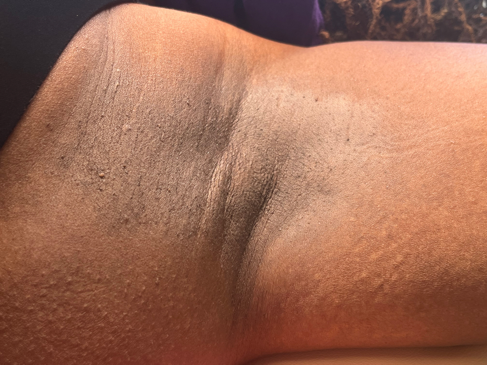 Underarm Wax