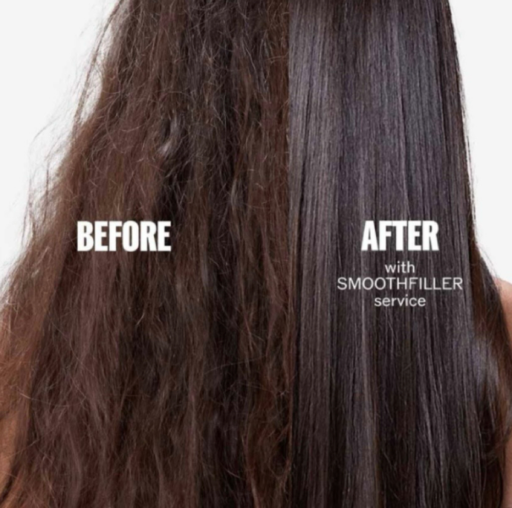 Smooth Filler at Beauty by Yere in Las Vegas, NV