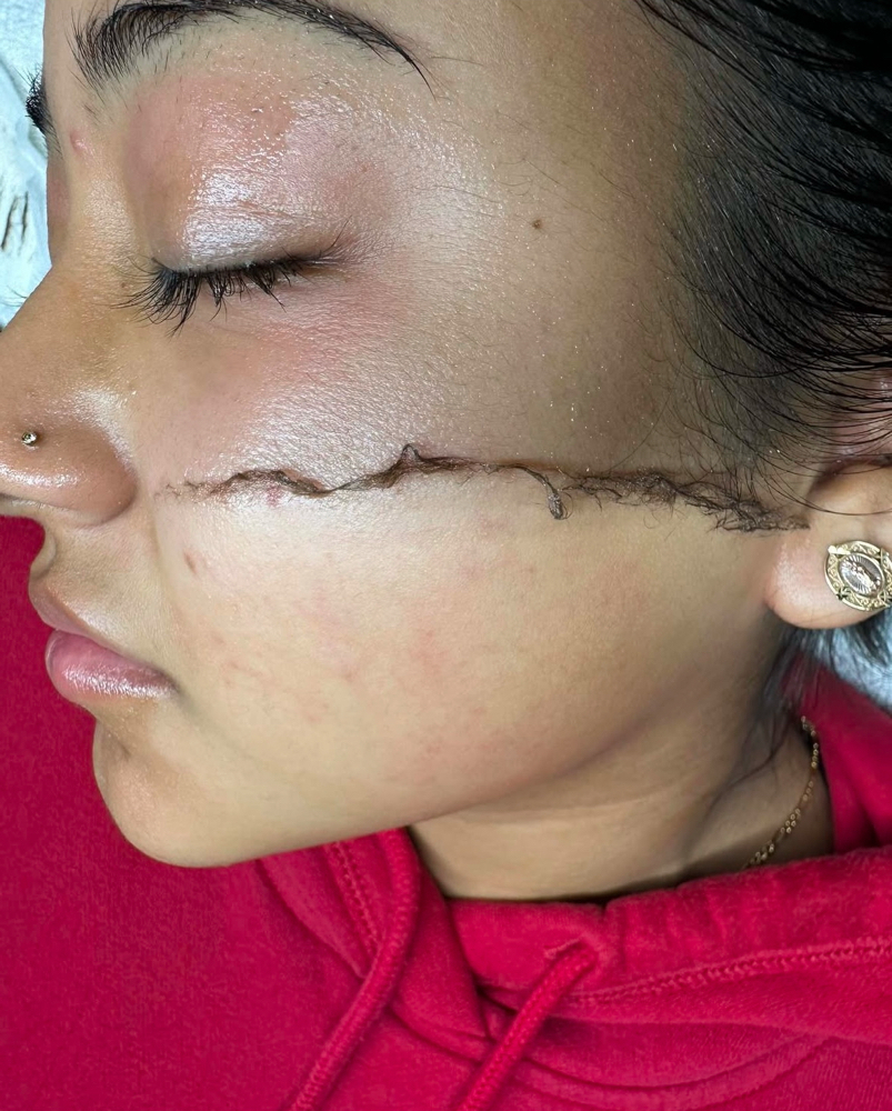 Dermaplane Facial