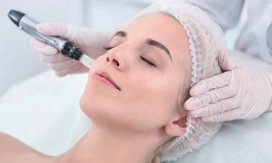 Microneedling