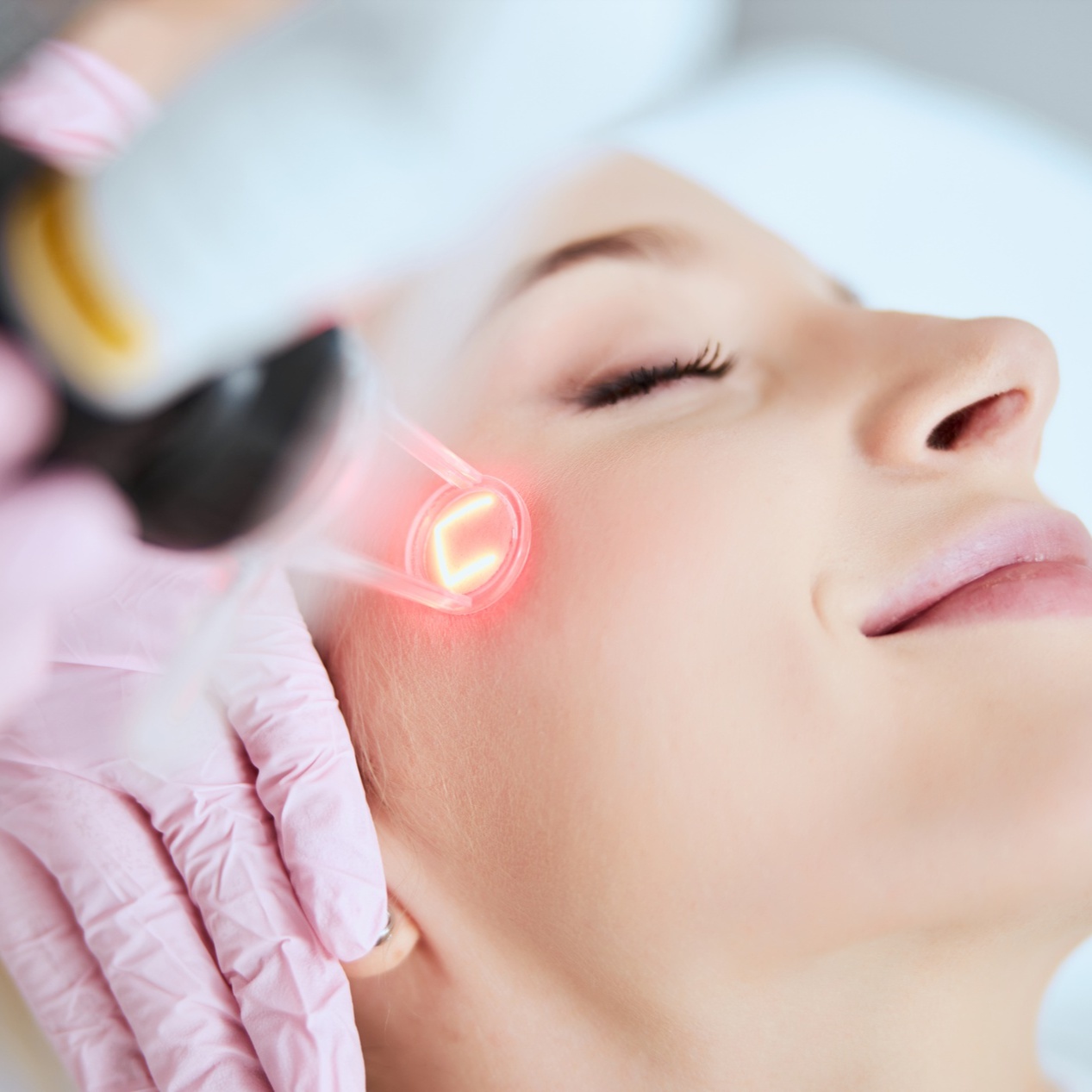 Laser Treatment at SKINVIEW ESTHETICS in Longview, TX