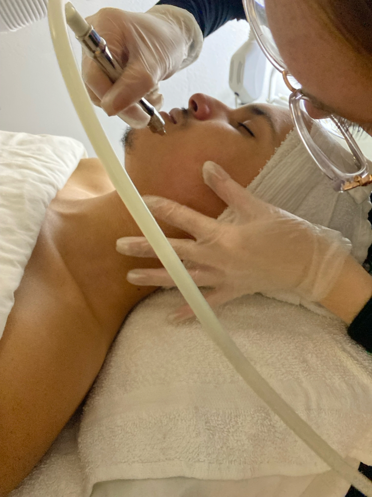 Inara Microdermabrasion Facial