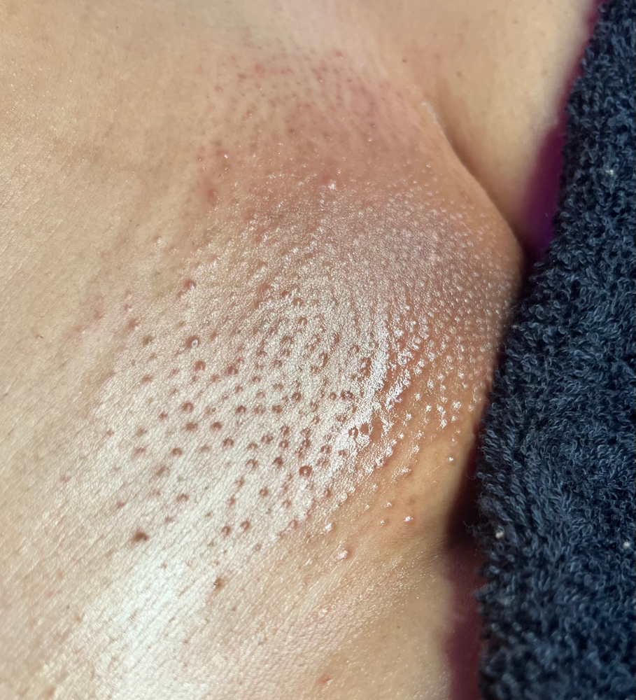 Bikini Wax