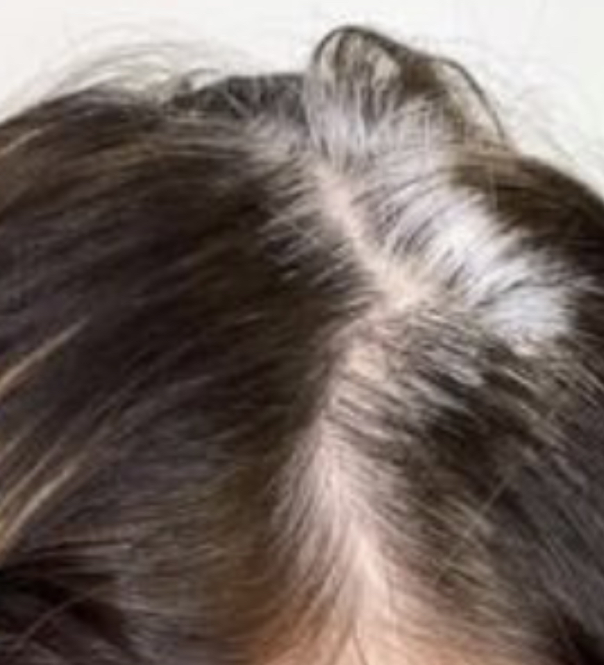 Root Retouch ( Deposit Only ) 3inch