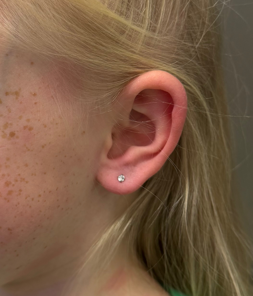 Earlobes (children 6-12 Yrs old)